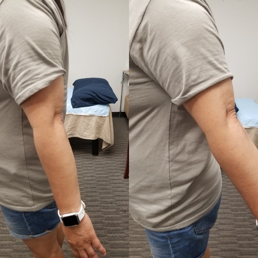 DENG ACUPUNCTURE AND HERB 423 Photos & 47 Reviews 4220 Rocklin Rd