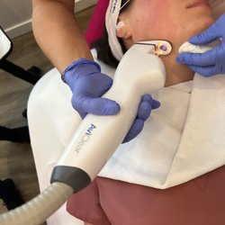 Lifted Beauty & Wellness - AviClear is the first FDA-cleared laser for acne.
