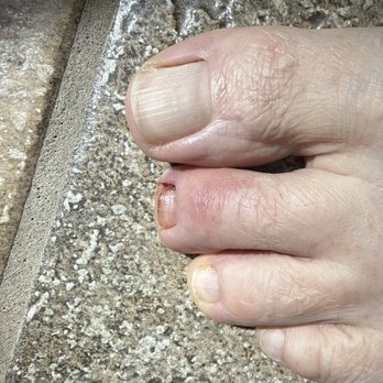 Star Nails - Second toe damage - Nail Salons Near Me - Oakhurst, California Star Nails - Second toe damage - Nail Salons Near Me - Oakhurst, California