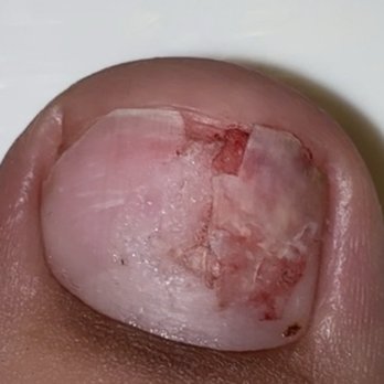 Oasis Nail Lounge - My toe! ouch - Nail Salons Near Me - Houston, Texas Oasis Nail Lounge - My toe! ouch - Nail Salons Near Me - Houston, Texas