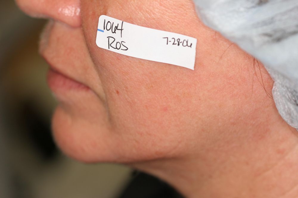 Ohio Laser & Wellness Centers Logo