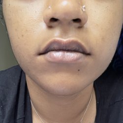 Skin By Shadi - After!!!