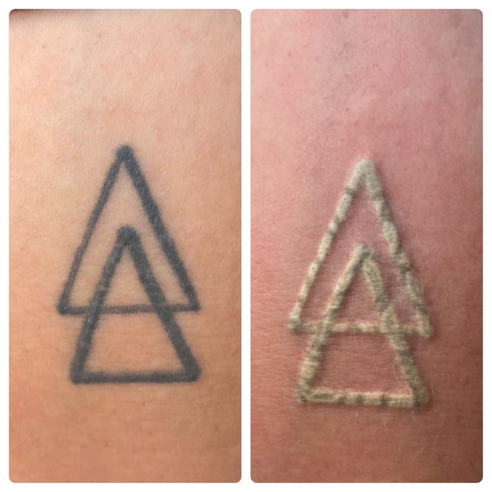 YUMA LASER CENTER Updated September 2024 2851 S Ave B, Yuma