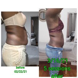 Star Beauty Body & Browz - Body Sculpting