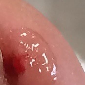 Elite Nails & Spa - After soaking in water astringent and alcohol, the bleeding finally stopped with the mystery ointment - Nail Salons Near Me - Chula Vista, California