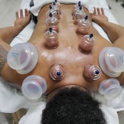 LM Therapeutics - Cupping