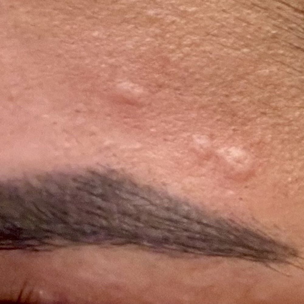 CC Cosmetics - Bumps that wont go away after really bad and careless eye brow waxing - Nail Salons Near Me - San Jose, California