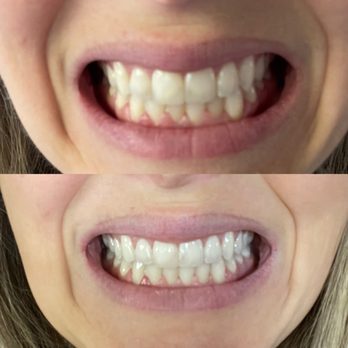 Anacapa Orthodontics - Orthodontists Near Me - Ventura, California