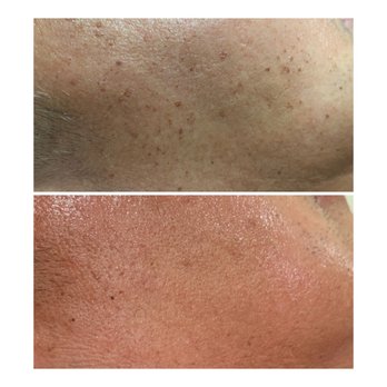 Skin Vogue - Skin Care Near Me - Pleasanton, California Skin Vogue - Skin Care Near Me - Pleasanton, California
