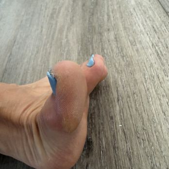 Venus Nails - Callous - Nail Salons Near Me - Fort Collins, Colorado Venus Nails - Callous - Nail Salons Near Me - Fort Collins, Colorado