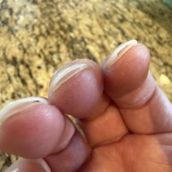 Lifted nails hammer only 3 Days