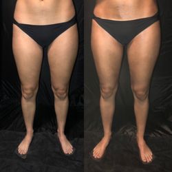 Warmth Tan Bar