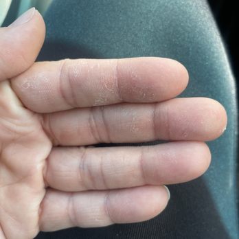Sweet Nails - Peeling of my skin - Nail Salons Near Me - Las Vegas, Nevada Sweet Nails - Peeling of my skin - Nail Salons Near Me - Las Vegas, Nevada