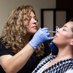Beautifully Made - Loyal client receiving Botox and Dermal Filler