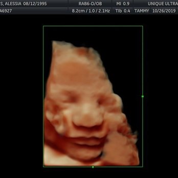 Unique Ultrasound - My little peanut - Diagnostic Imaging Near Me - Temecula, California Unique Ultrasound - My little peanut - Diagnostic Imaging Near Me - Temecula, California