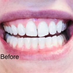 Evers & Gardner Dental - Before