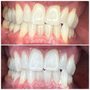 Photo of Bright Bites by Sadie, RDH