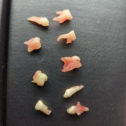 Eastside Pediatric Dentistry - 9 extracted teeth