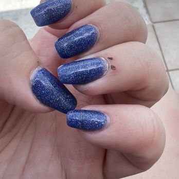 Casa Beauty - 1 week later, still have scabs. - Nail Salons Near Me - Aventura, Florida