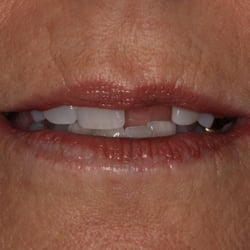 Sam Namdarian - Fresno Smile Makeovers - Before