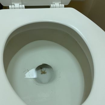 Kahler Inn & Suites - Stained toilet yuck - Hotels Near Me - Rochester, Minnesota Kahler Inn & Suites - Stained toilet yuck - Hotels Near Me - Rochester, Minnesota