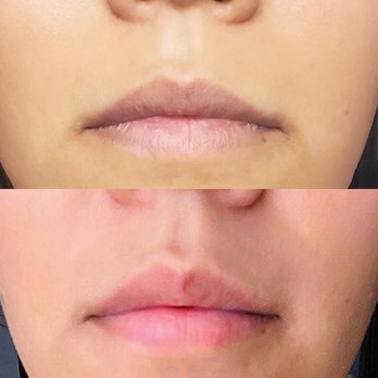 The Touch - Skin Care Near Me The Touch - Skin Care Near Me
