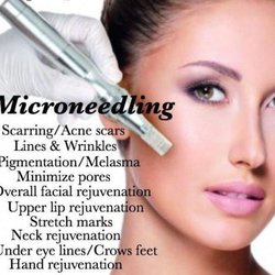 Rock, Paper, Scissors Full Body Waxing Boutique - Microneedling