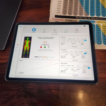 DexaFit Midtown Sac - My results on the tablet - Sports Medicine Near Me - Sacramento, California