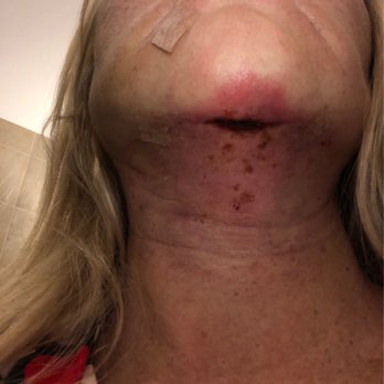 Miller Cosmetic Surgery Center - Scott R. Miller, MD, FACS - Concerns dealing healing - Cosmetic Surgeons Near Me - La Jolla, California