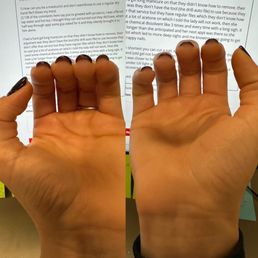 think, wavy nails on one with old gel not removed properly and the other more reasonable think, wavy nails on one with old gel not removed properly and the other more reasonable
