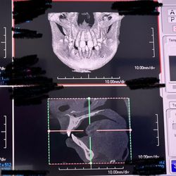 Merrill Ranch Family Dental - 3D imagining of my skull and teeth