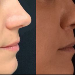 Left is what he said it would look like, the right is what he did!