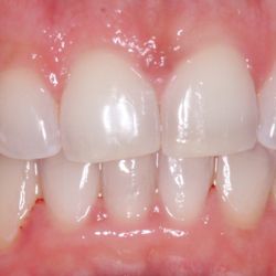 Fitzroy Dental
