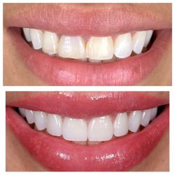 Park Ave Dental Aesthetics