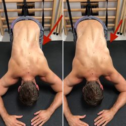 Almonte Physical Therapy & Schroth - 30 year old male working on expansion of his collapsed side. Schroth has to be very specific and done properly long term for results.