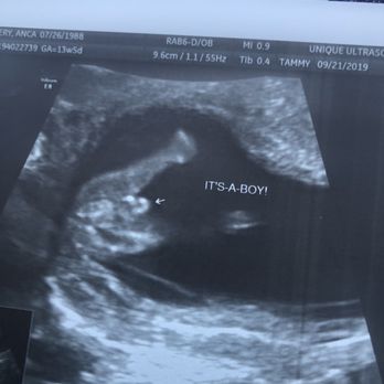 Unique Ultrasound - My little boy - Diagnostic Imaging Near Me - Temecula, California Unique Ultrasound - My little boy - Diagnostic Imaging Near Me - Temecula, California