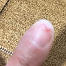 Bloody nail from service- beware! Bloody nail from service- beware!
