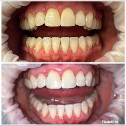 Smile Hy NV LLC - Before and after.