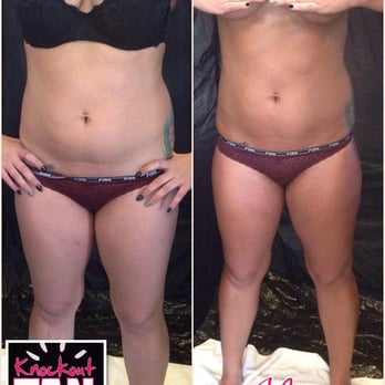 Knockout Tan - Spray Tanning Near Me