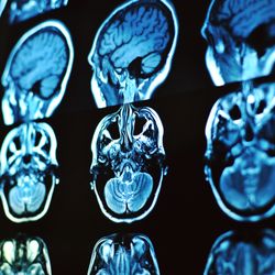 Bayfront Health Medical Group Neurology Port Charlotte - Stock photo of brain scans