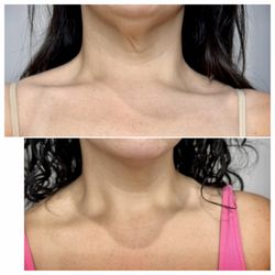 Beautifiller Skin