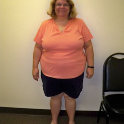 Physicians WEIGHT LOSS Centers - Karen before