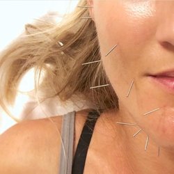 The Healing Well - Treatments for TMJ, acne, and cosmetics work wonders!