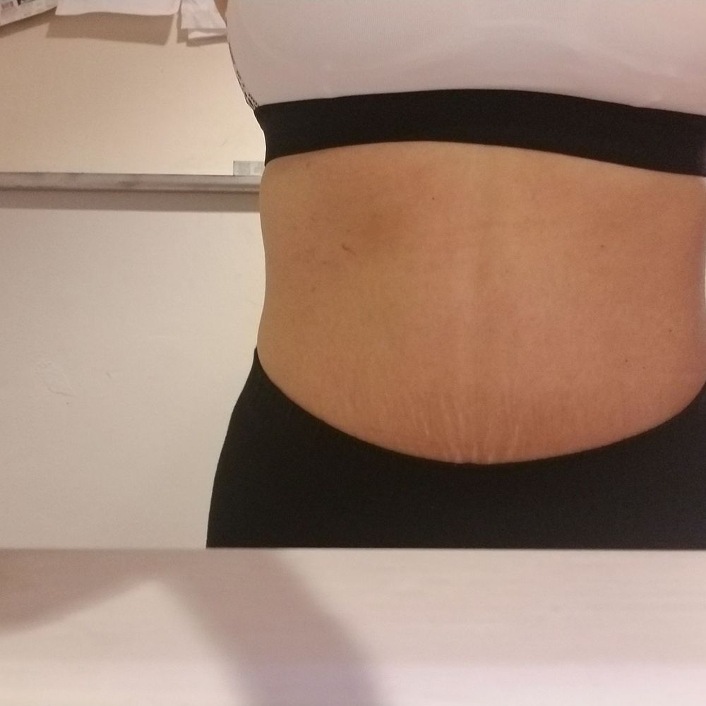 Jose A. Munoz - Plastic Surgeons Near Me - Lauderhill, Florida Jose A. Munoz - Plastic Surgeons Near Me - Lauderhill, Florida