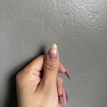 Dr Nails & Spa - After a week and a half, 3 nails chipped and broken off. Again, $90 for this set - Nail Salons Near Me - Anaheim, California Dr Nails & Spa - After a week and a half, 3 nails chipped and broken off. Again, $90 for this set - Nail Salons Near Me - Anaheim, California