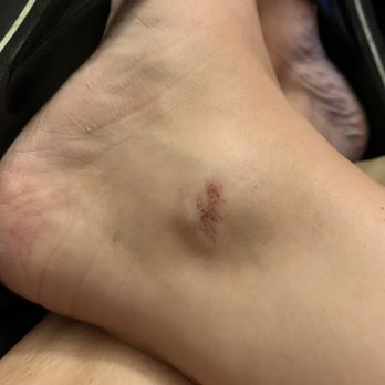 Fine Art Nails & Lashes - This is what they did to me when I got a pedicure on Wednesday. Don't go here . - Nail Salons Near Me - Everett, Massachusetts