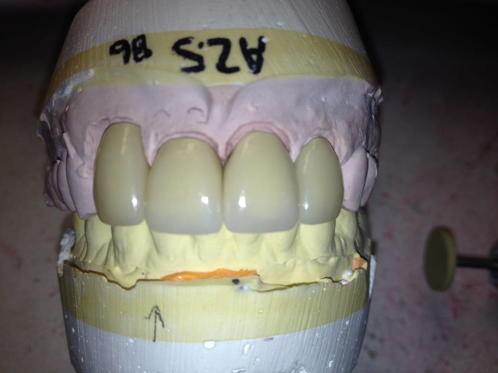 ROSENFELD DENTAL LAB Updated March 2024 1112 Colorado Blvd, Los