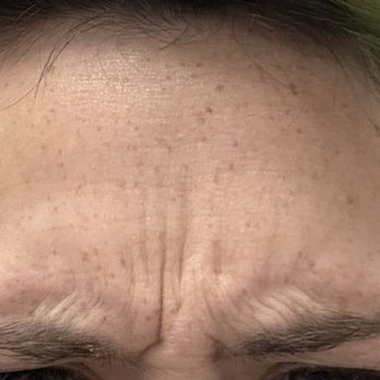 The Whole Tooth - Scrunching eyebrows. - General Dentistry Near Me - Dunwoody, Georgia The Whole Tooth - Scrunching eyebrows. - General Dentistry Near Me - Dunwoody, Georgia
