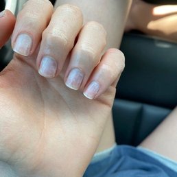 Ring finger - skin where she electronically accidentally filed the cuticle and beyond, which caused me to say "ow" Ring finger - skin where she electronically accidentally filed the cuticle and beyond, which caused me to say "ow"