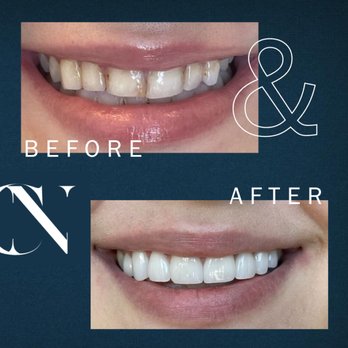 Clint Newman - Smile Makeover Results at Clint Newman, DDS | Nashville, TN - Cosmetic Dentists Near Me - Nashville, Tennessee Clint Newman - Smile Makeover Results at Clint Newman, DDS | Nashville, TN - Cosmetic Dentists Near Me - Nashville, Tennessee